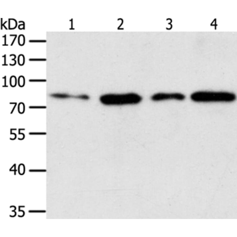TGM2 Antibody from Signalway Antibody (35959) - Antibodies.com