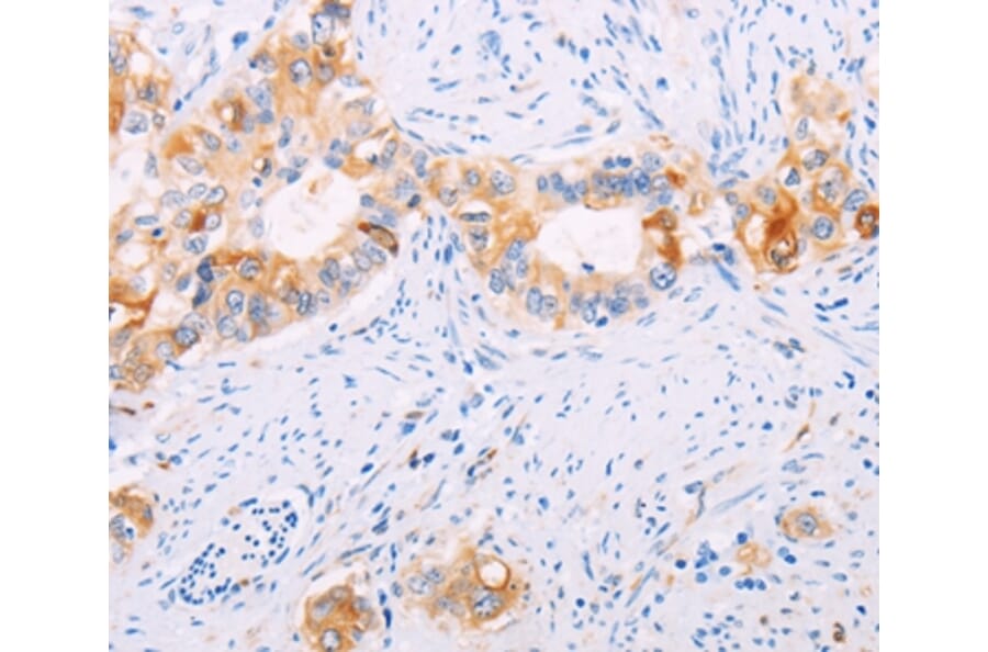 Immunohistochemistry - TGM2 Antibody from Signalway Antibody (35959) - Antibodies.com