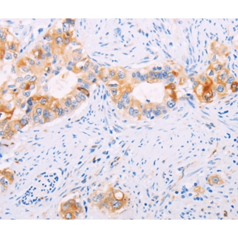 Immunohistochemistry - TGM2 Antibody from Signalway Antibody (35959) - Antibodies.com