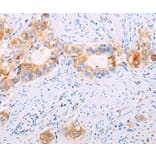 Immunohistochemistry - TGM2 Antibody from Signalway Antibody (35959) - Antibodies.com