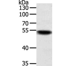 SUFU Antibody from Signalway Antibody (35993) - Antibodies.com