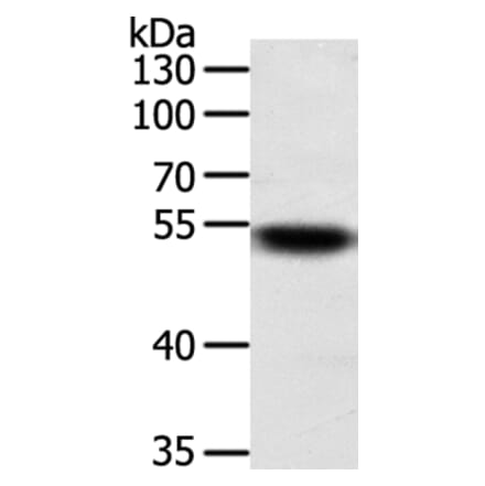 SUFU Antibody from Signalway Antibody (35993) - Antibodies.com