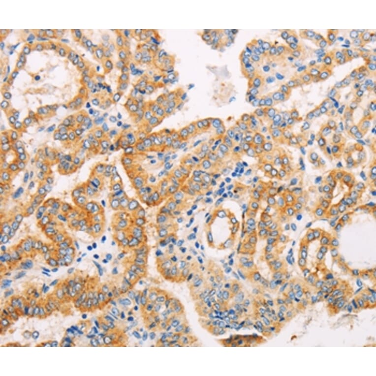 Immunohistochemistry - SUFU Antibody from Signalway Antibody (35993) - Antibodies.com