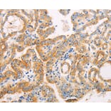 Immunohistochemistry - SUFU Antibody from Signalway Antibody (35993) - Antibodies.com