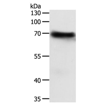 FZD4 Antibody from Signalway Antibody (35998) - Antibodies.com