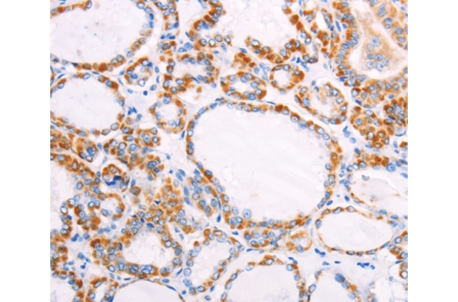 Immunohistochemistry - FZD4 Antibody from Signalway Antibody (35998) - Antibodies.com