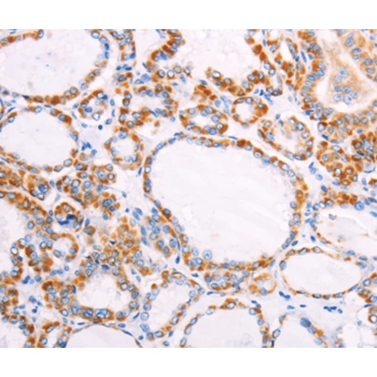 Immunohistochemistry - FZD4 Antibody from Signalway Antibody (35998) - Antibodies.com