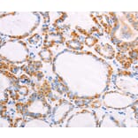 Immunohistochemistry - FZD4 Antibody from Signalway Antibody (35998) - Antibodies.com