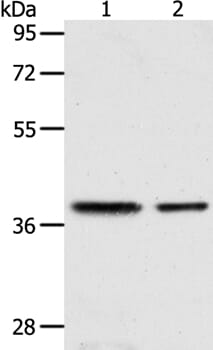Gel: 10% SDS-PAGE Lysates (from left to right): Human fetal kidney and fetal muscle tissue Amount of lysate: 40ug per lane Primary antibody: 1/400 dilution Secondary antibody dilution: 1/8000 Exposure time: 1 minute