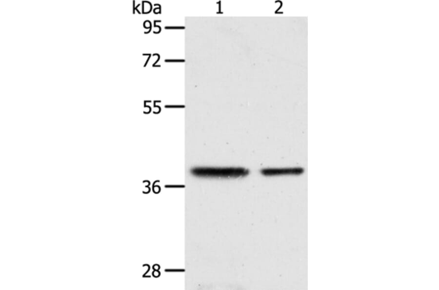 CNN3 Antibody from Signalway Antibody (36018) - Antibodies.com