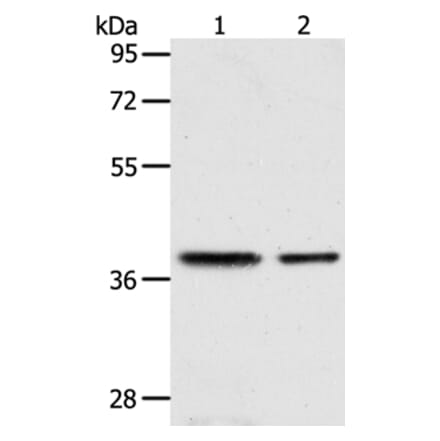CNN3 Antibody from Signalway Antibody (36018) - Antibodies.com