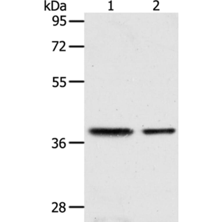 CNN3 Antibody from Signalway Antibody (36018) - Antibodies.com