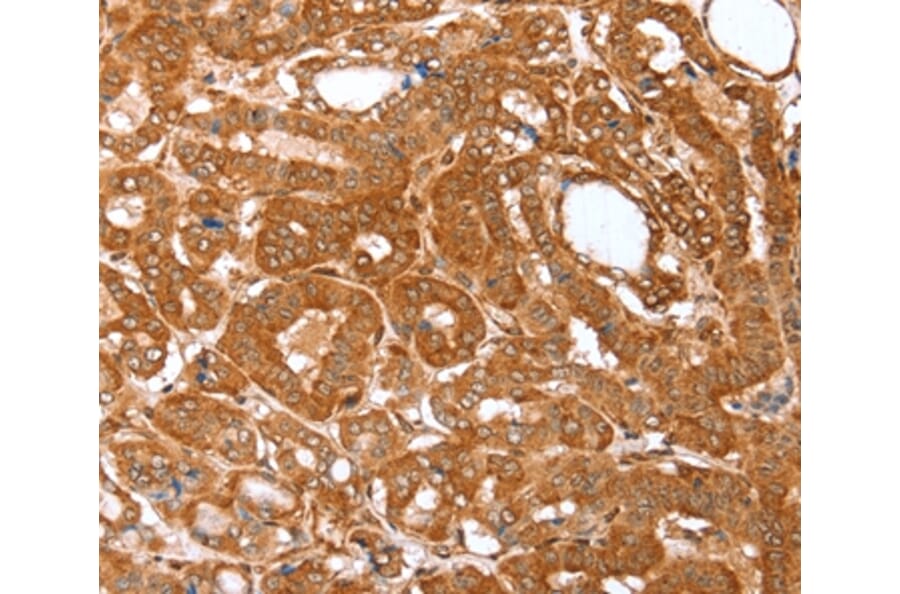 Immunohistochemistry - CNN3 Antibody from Signalway Antibody (36018) - Antibodies.com