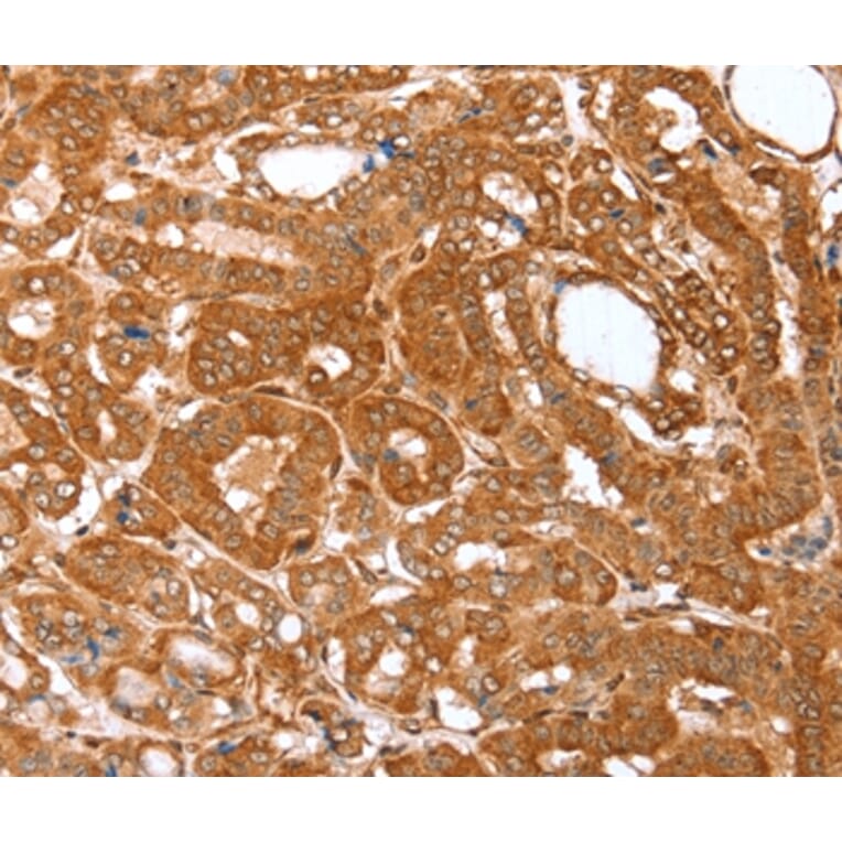 Immunohistochemistry - CNN3 Antibody from Signalway Antibody (36018) - Antibodies.com