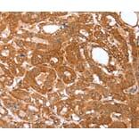 Immunohistochemistry - CNN3 Antibody from Signalway Antibody (36018) - Antibodies.com