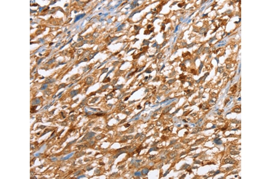 Immunohistochemistry - CAPG Antibody from Signalway Antibody (36027) - Antibodies.com