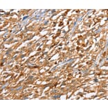 Immunohistochemistry - CAPG Antibody from Signalway Antibody (36027) - Antibodies.com