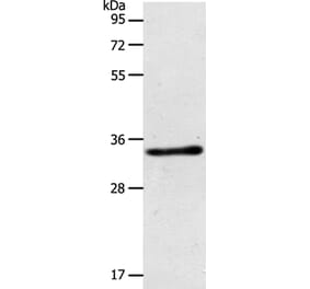 ACY3 Antibody from Signalway Antibody (36034) - Antibodies.com