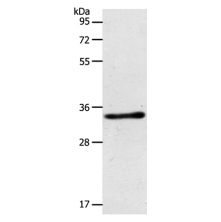 ACY3 Antibody from Signalway Antibody (36034) - Antibodies.com