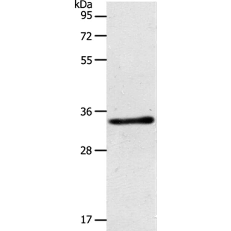 ACY3 Antibody from Signalway Antibody (36034) - Antibodies.com