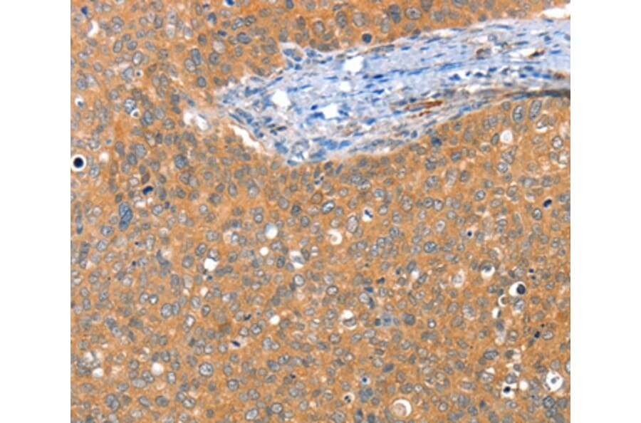 Immunohistochemistry - ACY3 Antibody from Signalway Antibody (36034) - Antibodies.com