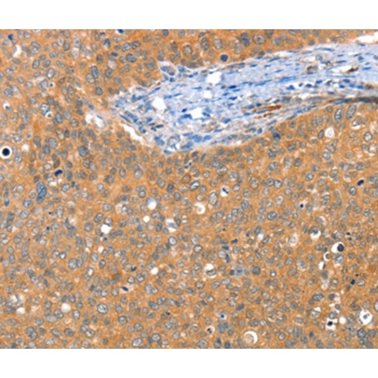 Immunohistochemistry - ACY3 Antibody from Signalway Antibody (36034) - Antibodies.com