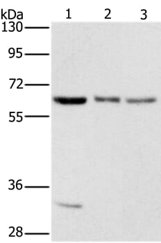 Gel: 8% SDS-PAGE Lysates (from left to right): 293T, hela and PC3 cell Amount of lysate: 40ug per lane Primary antibody: 1/400 dilution Secondary antibody dilution: 1/8000 Exposure time: 10 seconds
