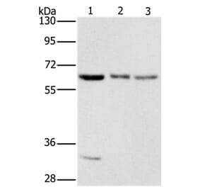AAAS Antibody from Signalway Antibody (36054) - Antibodies.com