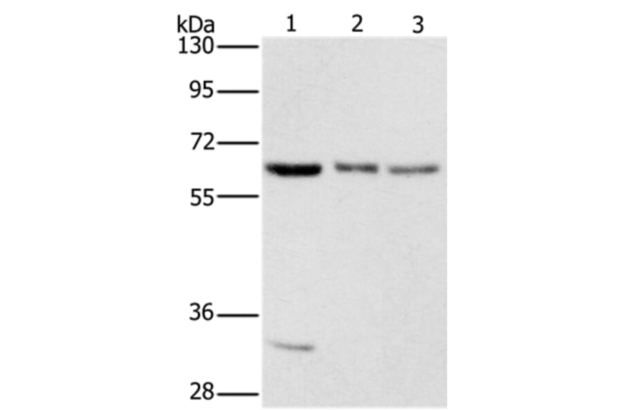 Anti-AAAS Antibody (A38700) | Antibodies.com