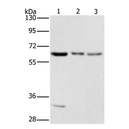 AAAS Antibody from Signalway Antibody (36054) - Antibodies.com