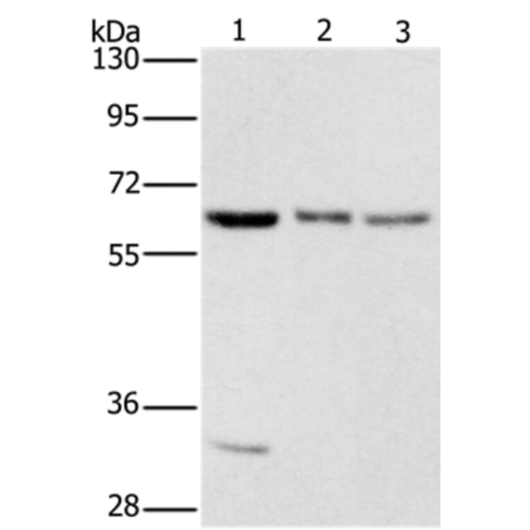 Anti-AAAS Antibody (A38700) | Antibodies.com