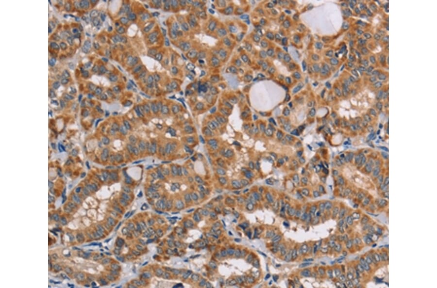 Immunohistochemistry - AAAS Antibody from Signalway Antibody (36054) - Antibodies.com