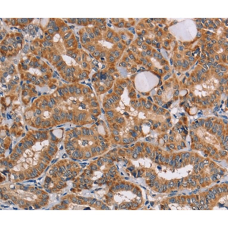 Immunohistochemistry - AAAS Antibody from Signalway Antibody (36054) - Antibodies.com