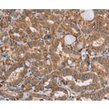 Immunohistochemistry - AAAS Antibody from Signalway Antibody (36054) - Antibodies.com