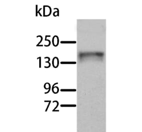 AOX1 Antibody from Signalway Antibody (36076) - Antibodies.com