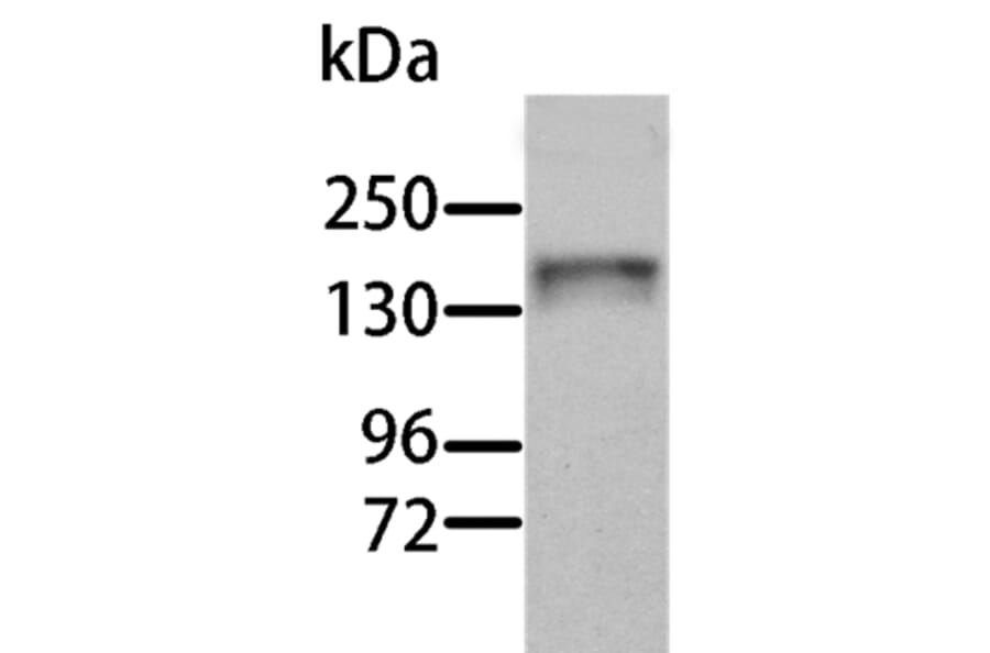 AOX1 Antibody from Signalway Antibody (36076) - Antibodies.com