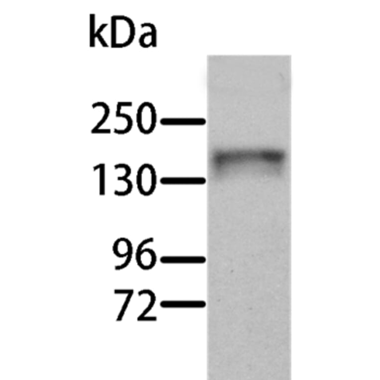 AOX1 Antibody from Signalway Antibody (36076) - Antibodies.com
