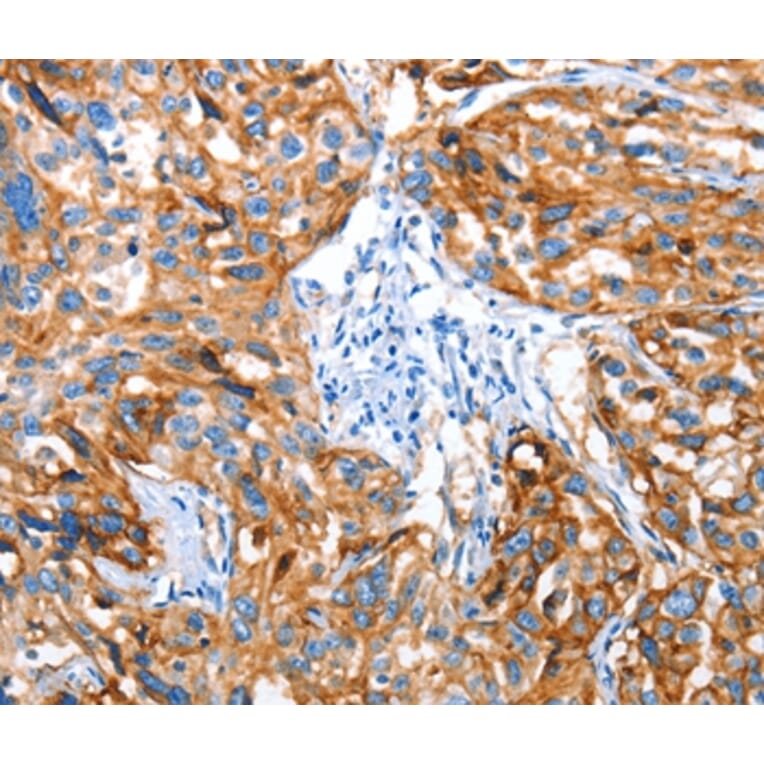 Immunohistochemistry - AOX1 Antibody from Signalway Antibody (36076) - Antibodies.com