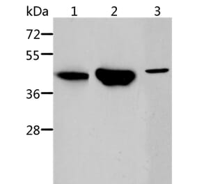 ACY1 Antibody from Signalway Antibody (36096) - Antibodies.com