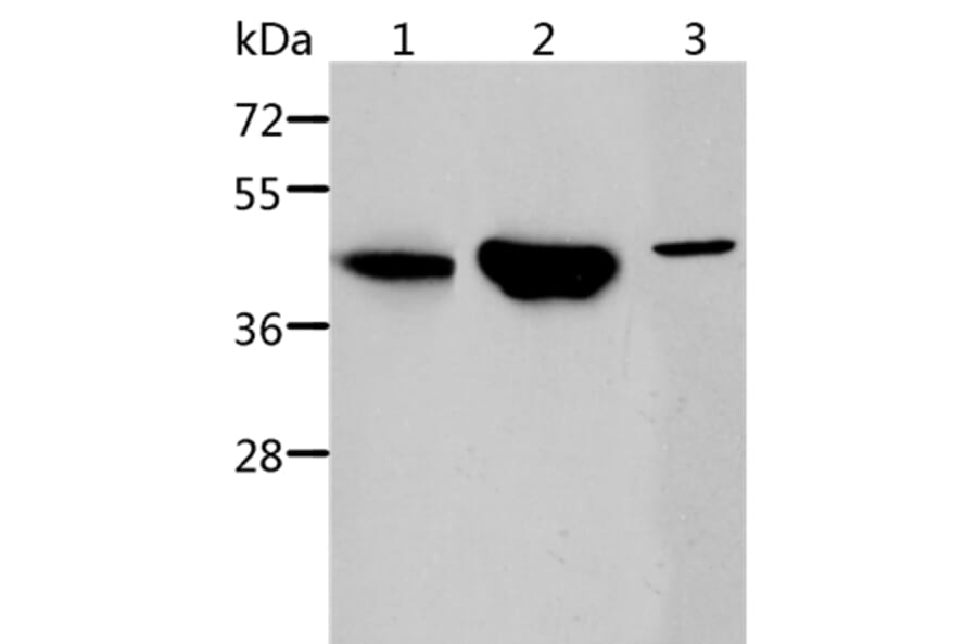 ACY1 Antibody from Signalway Antibody (36096) - Antibodies.com