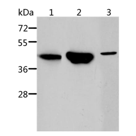 ACY1 Antibody from Signalway Antibody (36096) - Antibodies.com
