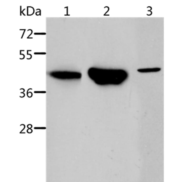 ACY1 Antibody from Signalway Antibody (36096) - Antibodies.com
