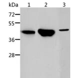 ACY1 Antibody from Signalway Antibody (36096) - Antibodies.com
