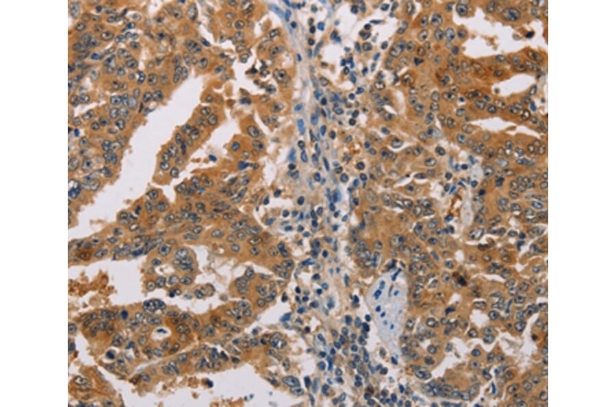 Immunohistochemistry - ACY1 Antibody from Signalway Antibody (36096) - Antibodies.com