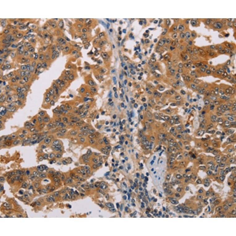 Immunohistochemistry - ACY1 Antibody from Signalway Antibody (36096) - Antibodies.com