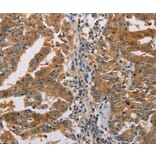 Immunohistochemistry - ACY1 Antibody from Signalway Antibody (36096) - Antibodies.com