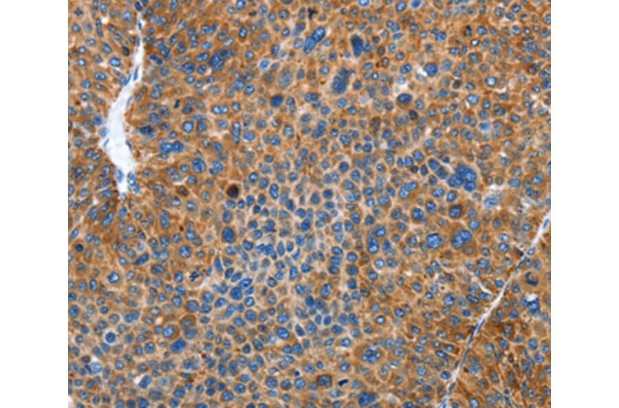 Immunohistochemistry - AUP1 Antibody from Signalway Antibody (36100) - Antibodies.com