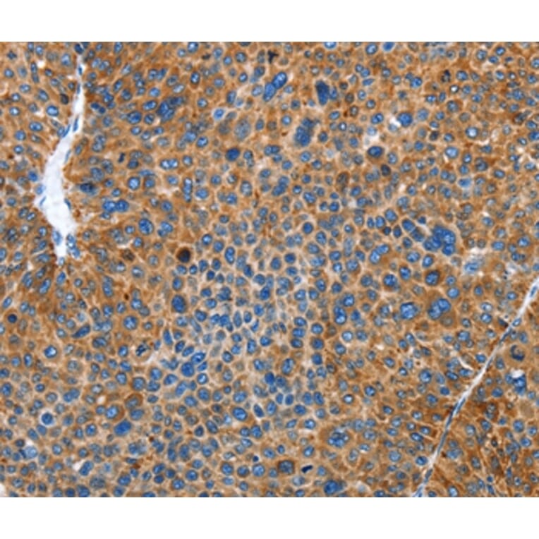 Immunohistochemistry - AUP1 Antibody from Signalway Antibody (36100) - Antibodies.com