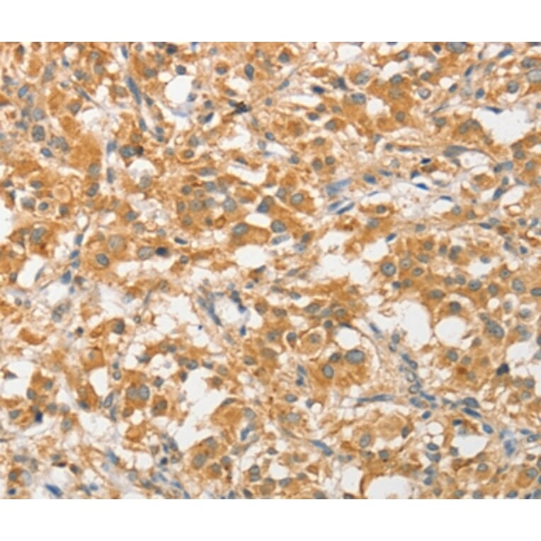 Immunohistochemistry - ATG5 Antibody from Signalway Antibody (36116) - Antibodies.com