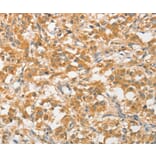 Immunohistochemistry - ATG5 Antibody from Signalway Antibody (36116) - Antibodies.com